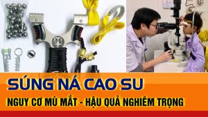 Súng Ná Cao Su 