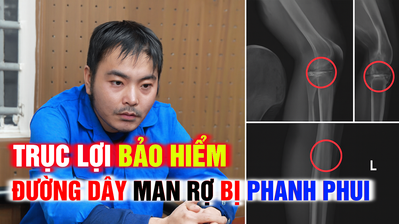 Trục Lợi Bảo Hiểm